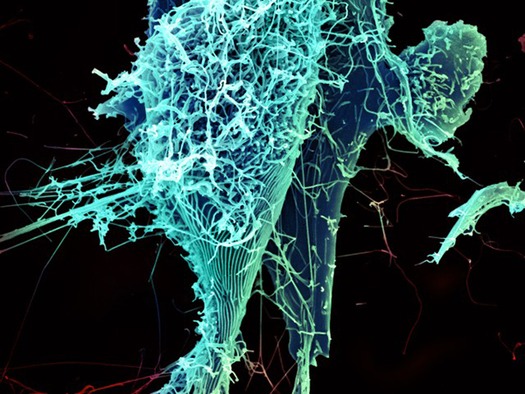 RNS-EBOLA-OUTBREAK
