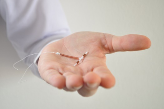 IUD birth control