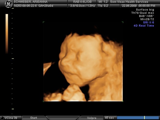 ultrasound