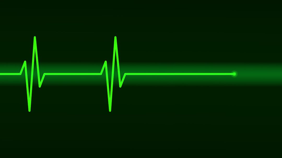 RNS-electrocardiogram-graphic1 031221