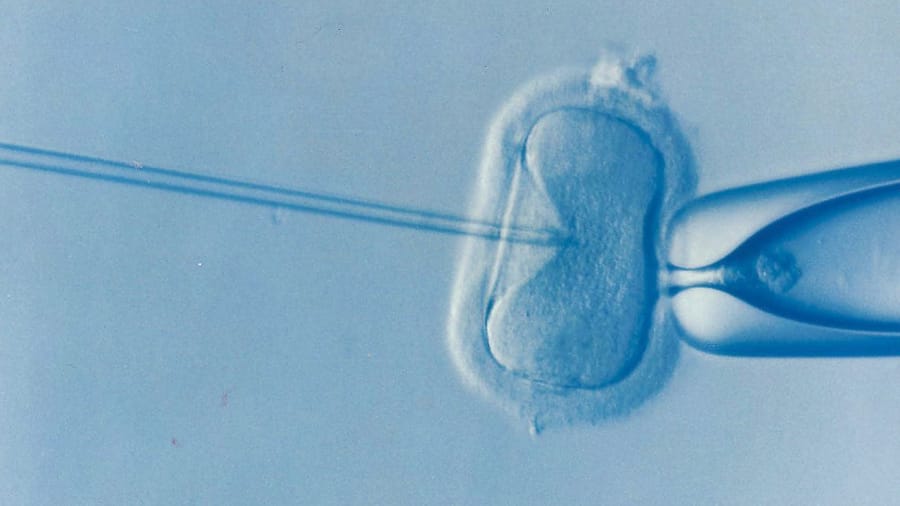 RNS-IVF-Embryo1b