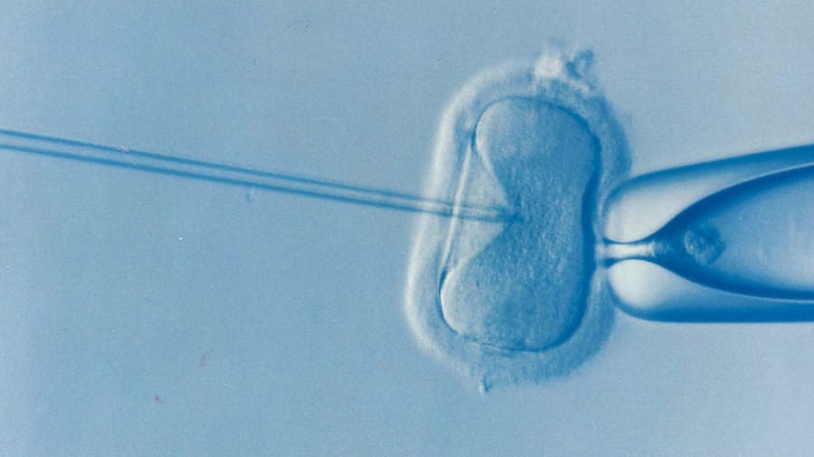 RNS-IVF-Embryo1