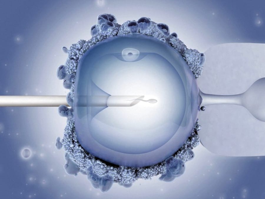 webRNS-IVF-Fertilization2